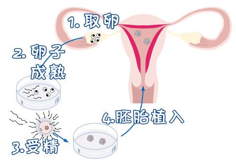 关于代生男孩包性别